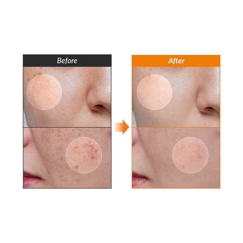 Dr. Althea - Vitamin C Boosting Serum