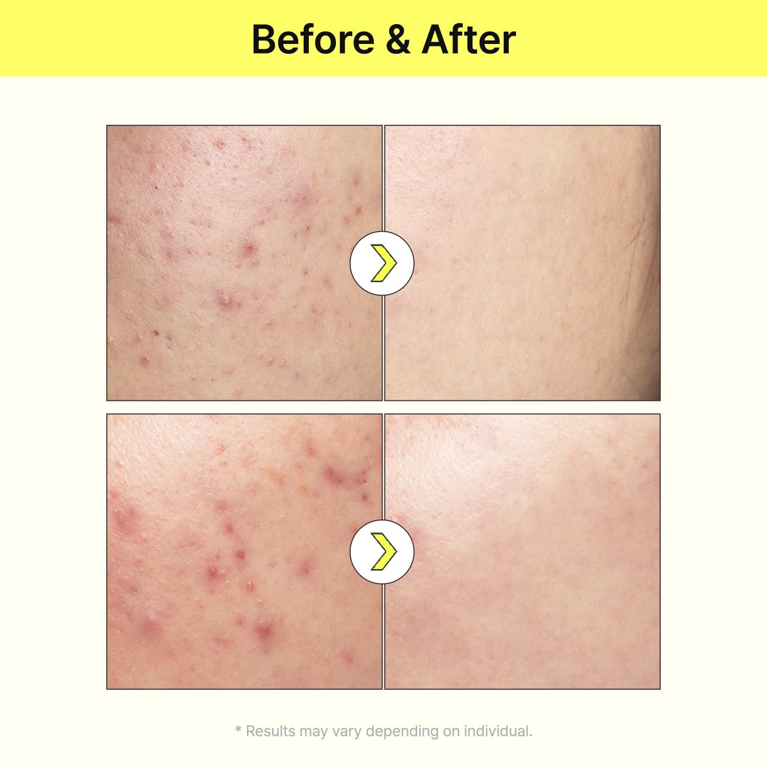TIAM VITA B3 SOURCE NIACINAMIDE 40ML