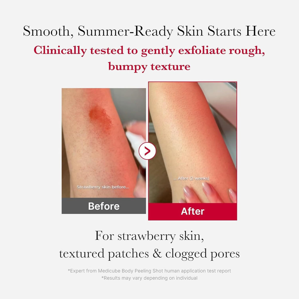 Medicube – Red Acne Body Peeling Shot (110g)