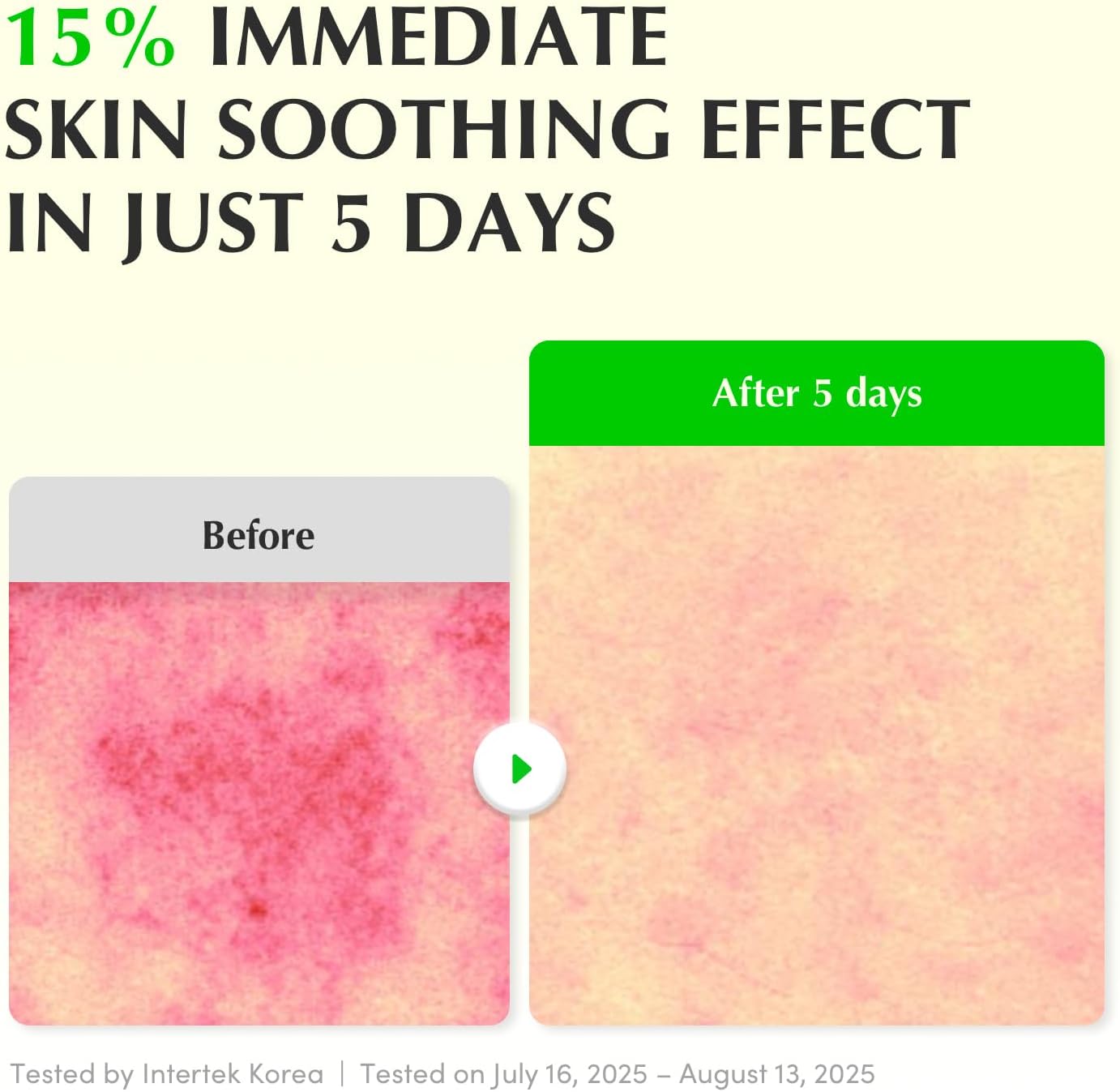 EQQUALBERRY - Aloe PDRN Calming Serum