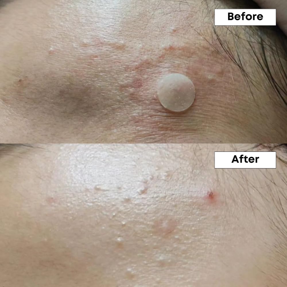 NINELESS - A-Control 10% Azelaic Acid Serum 30 ml