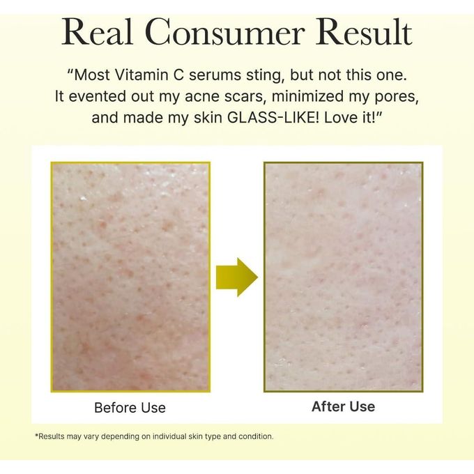 Arencia - Vitamin C Brightening Booster Cream, Glow-Enhancing Moisturizer with Vitamin C, TXA & Glutathione