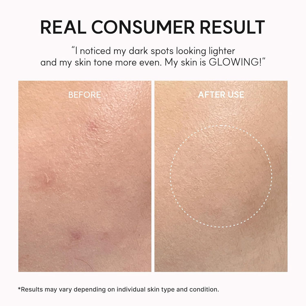 Arencia - TXA Booster Shot, Intensive Dark Spot Correcting Serum with 5% TXA, Niacinamide & 10 Peptides