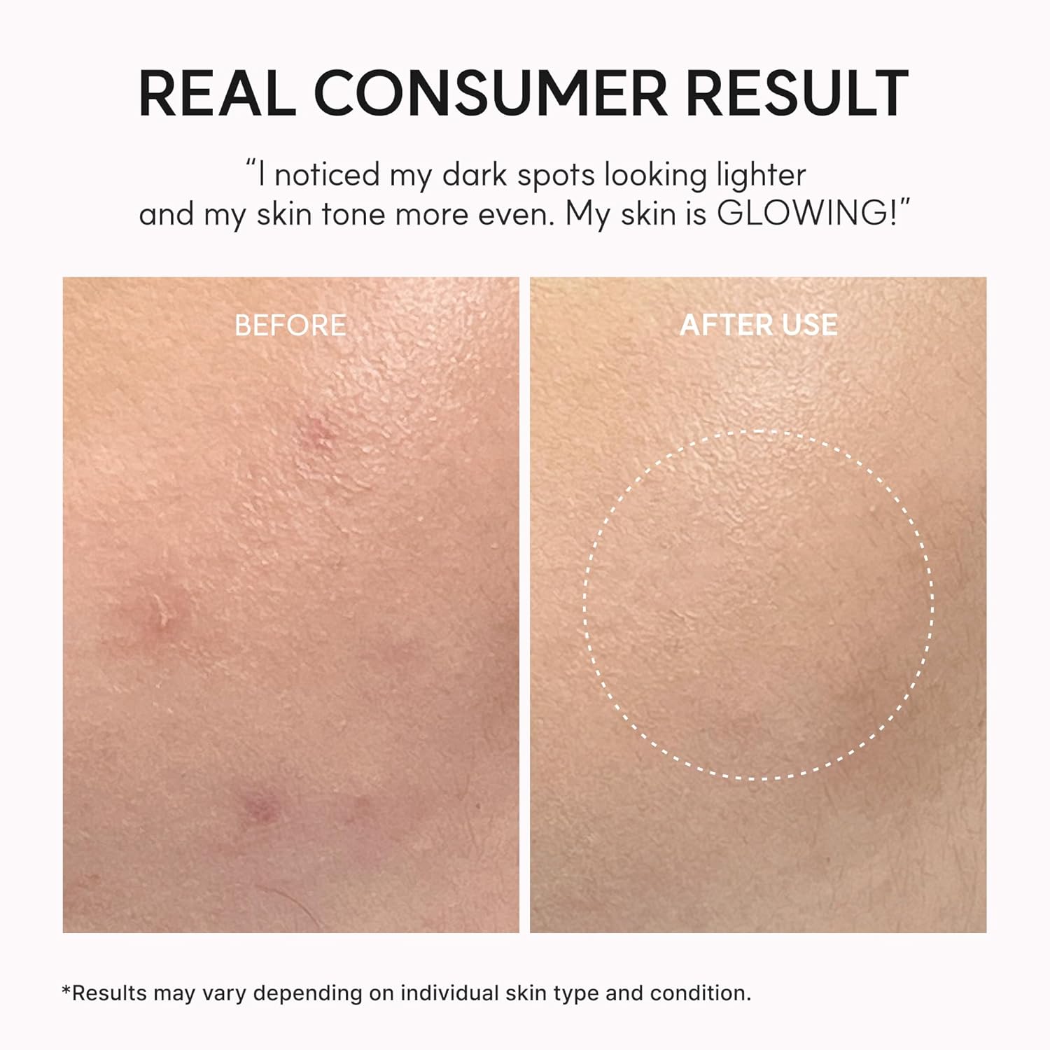 Arencia - TXA Booster Shot, Intensive Dark Spot Correcting Serum with 5% TXA, Niacinamide & 10 Peptides