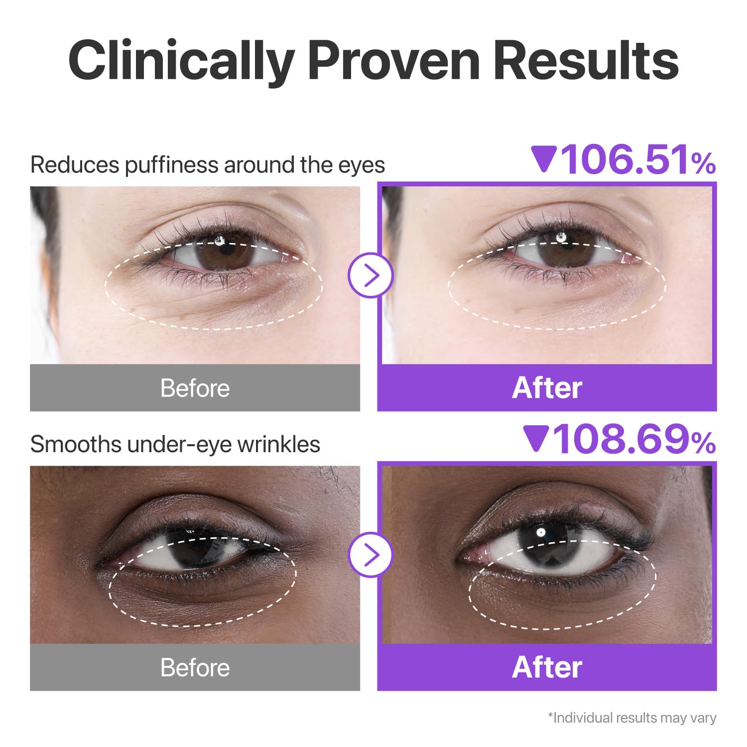 numbuzin – No.9 NAD+ Collagen Under Eye Patches