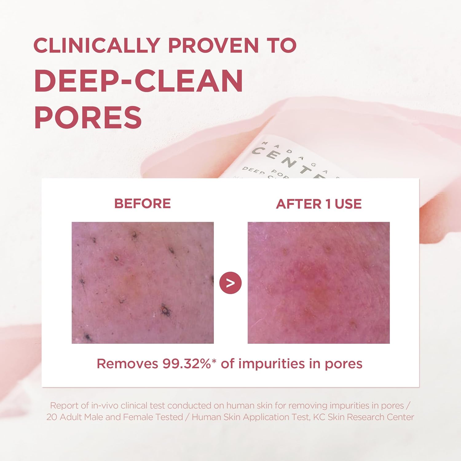 SKIN1004 - Madagascar Centella Poremizing Deep Cleansing Foam