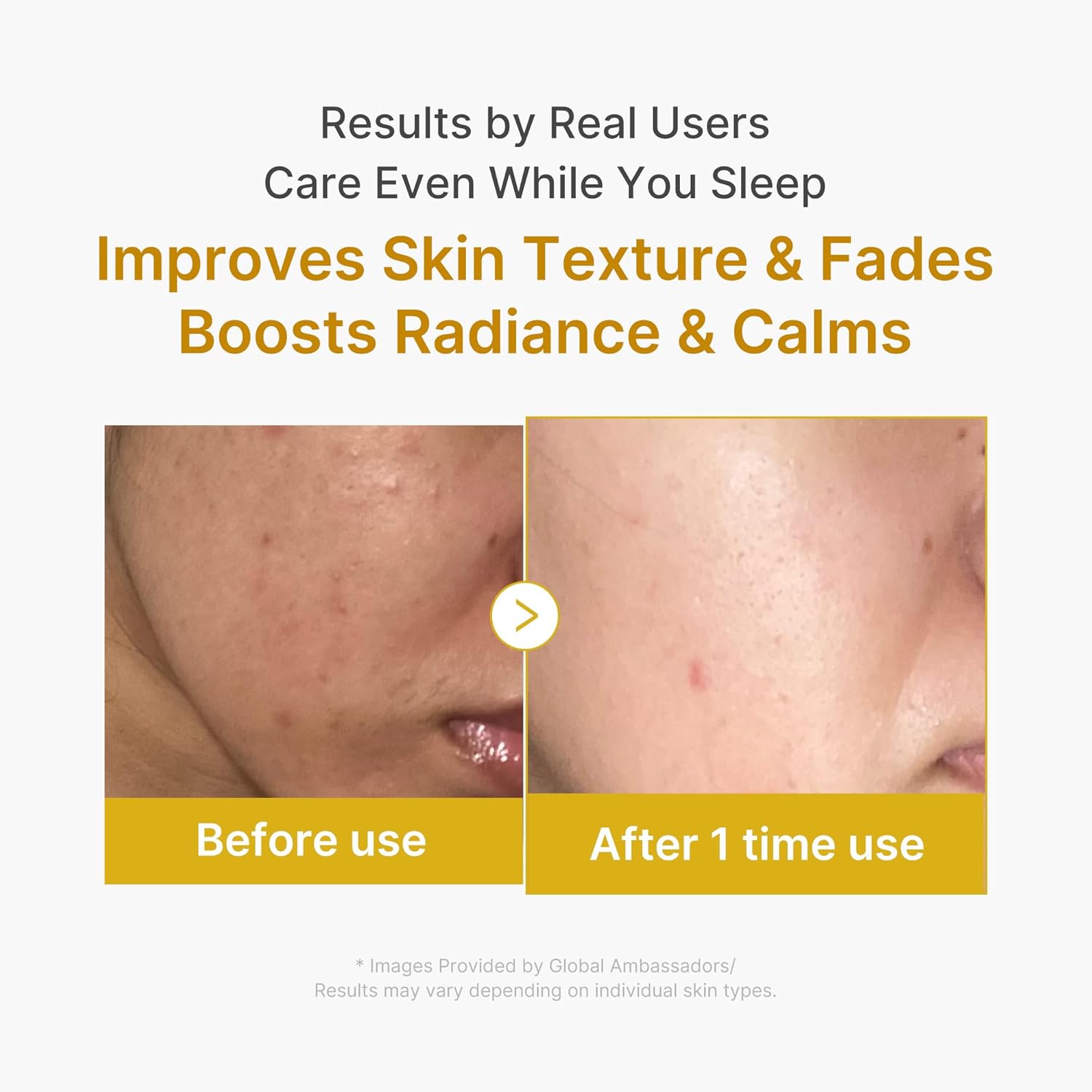 medicube - Kojic Acid Turmeric Night Wrapping Mask