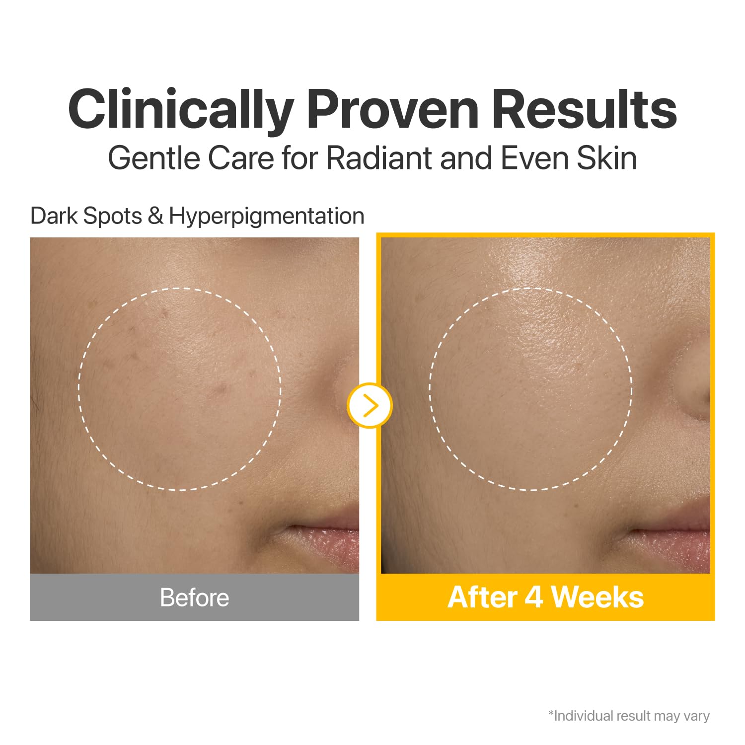 Numbuzin - No.5 Vitamin Concentrated Serum