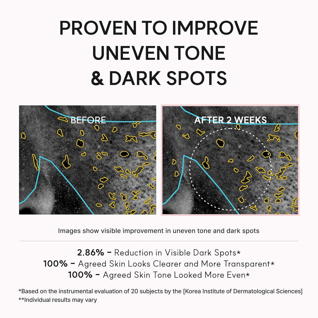 Arencia - TXA Booster Shot, Intensive Dark Spot Correcting Serum with 5% TXA, Niacinamide & 10 Peptides