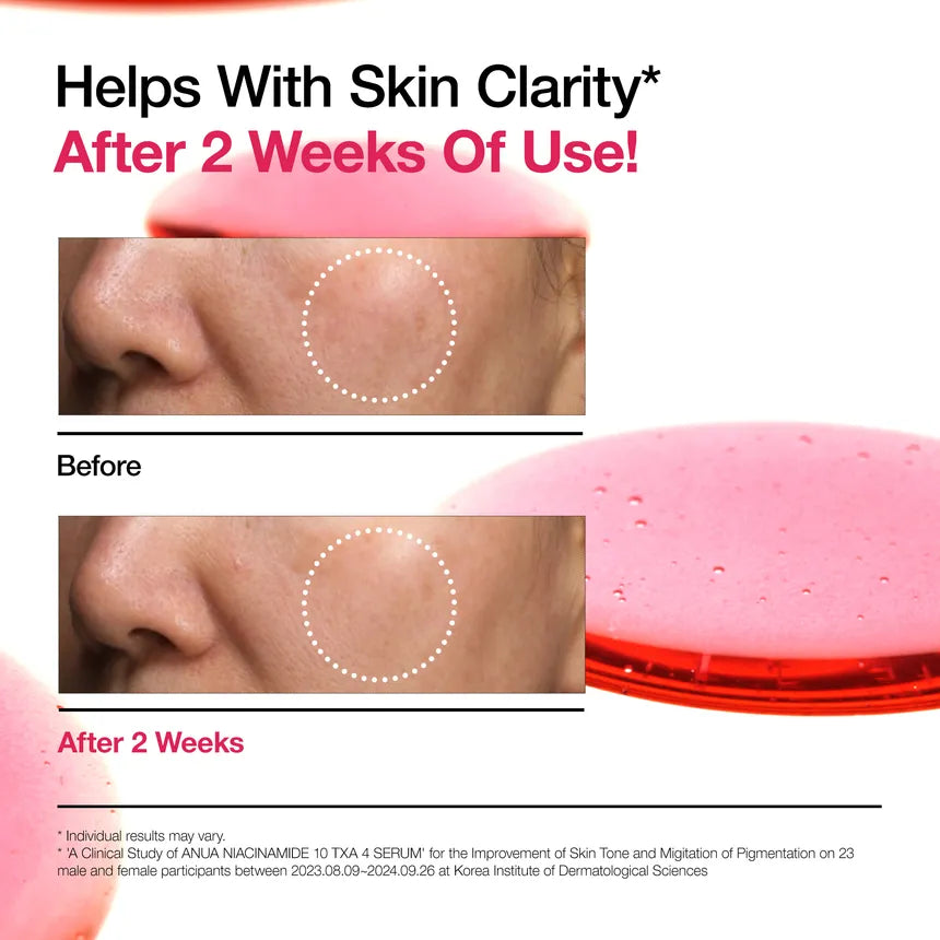 Anua - Niacinamide 10% + TXA 4% Dark Spot Correcting Serum
