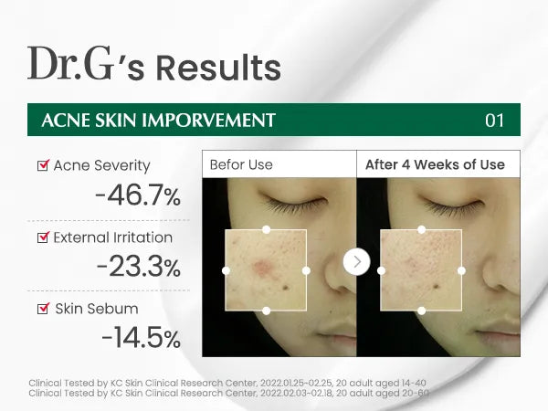 Dr.G R.E.D Blemish Clear Soothing Cream | Calming Moisturizer for Acne-Prone & Sensitive Skin (70ml)