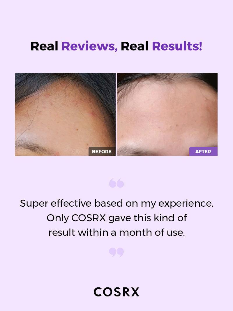 COSRX - AHA/BHA Clarifying Treatment Toner