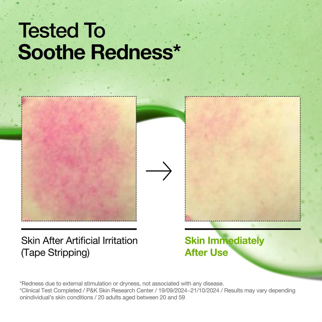 Anua - Azelaic Acid 10 Hyaluron Redness Smoothing Serum 30ml